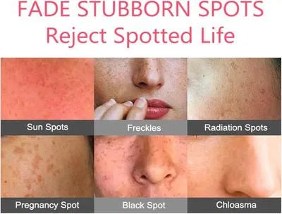 High Pigmented Face Cream for Acne Scar Removal - 20 Ml