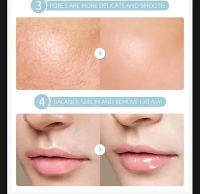 Cell Operated Bleach Cream