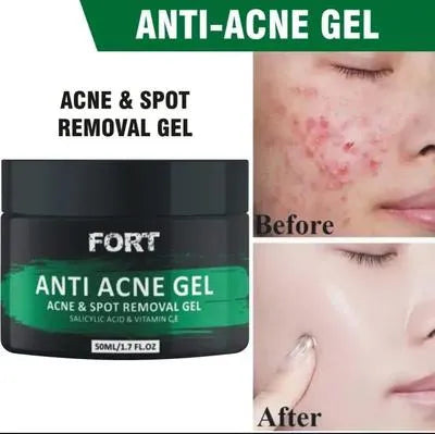 Uptown La Acne Scar Removal Exfoliating Gel