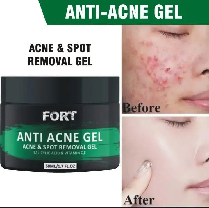 Uptown La Acne Scar Removal Exfoliating Gel